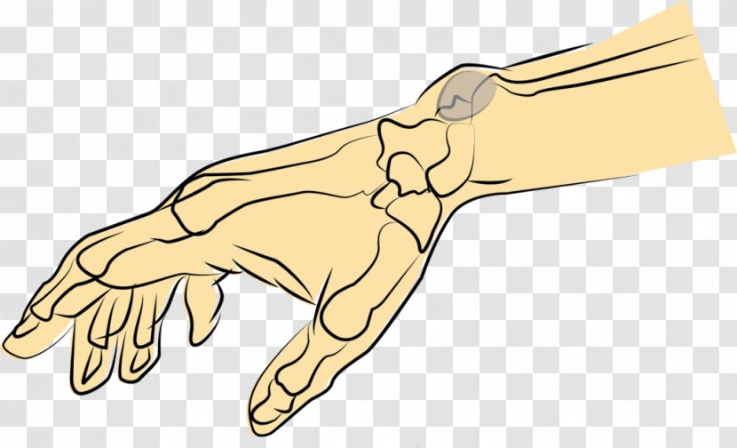 Thumb Synovial Cyst Hand Membrane - Organism Transparent PNG