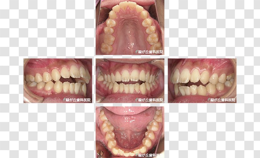 矯正歯科 Dentist Dental Braces Dentition Tooth - Tree - Ortho Transparent PNG
