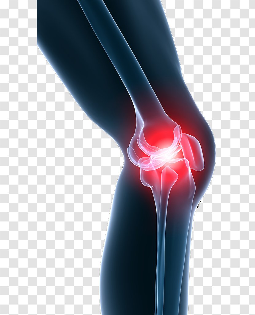 Knee Pain Shoulder Stem-cell Therapy - Plateletrich Plasma Transparent PNG