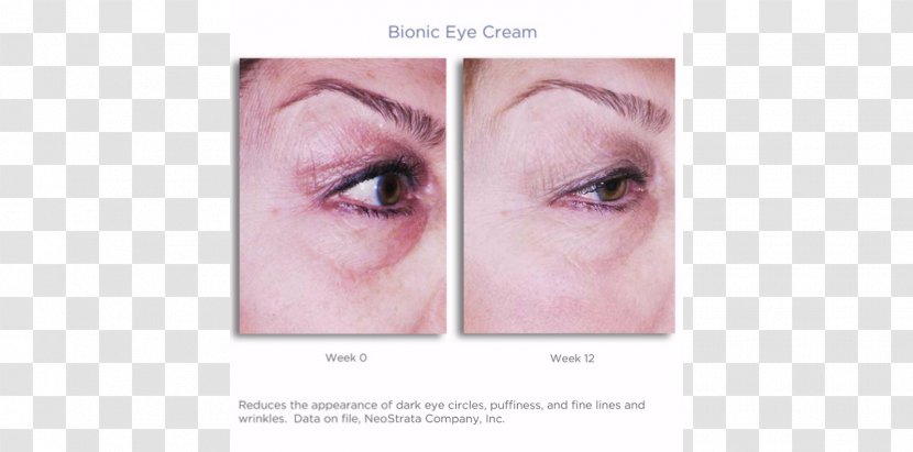 Periorbital Dark Circles Cream Eyelash Extensions Visual Prosthesis - Tree - Eye Transparent PNG
