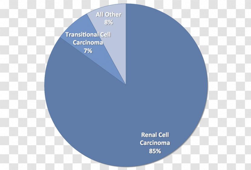 Kidney Cancer Tumour Renal Cell Carcinoma Transparent PNG