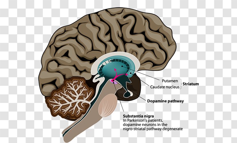 Parkinson's Disease Deep Brain Stimulation Neuroimaging - Jaw Transparent PNG