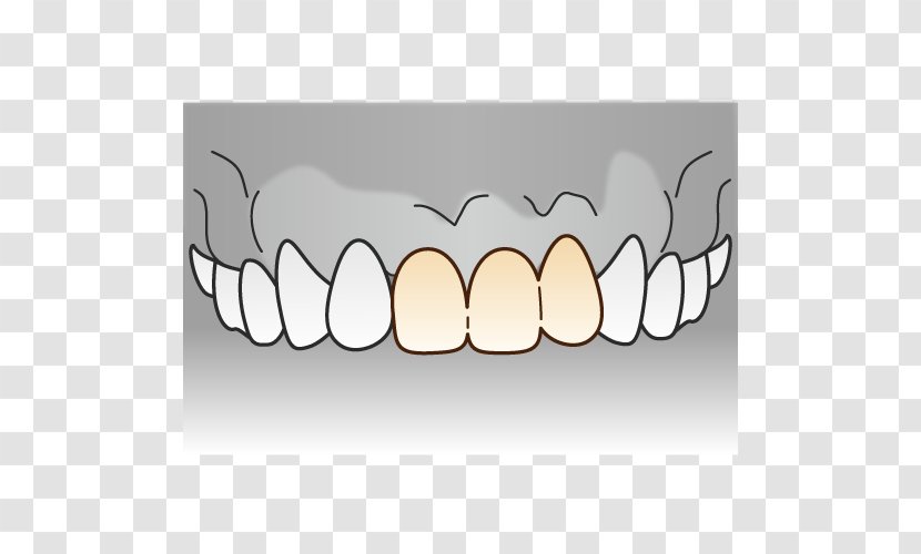 Tooth Dentist Dentures 審美歯科 - Cartoon - Bridge Transparent PNG