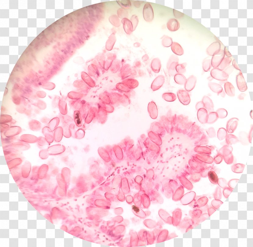 Protist Cyclospora Cayetanensis Adibide Wikipedia Protozoa - Liver Transparent PNG