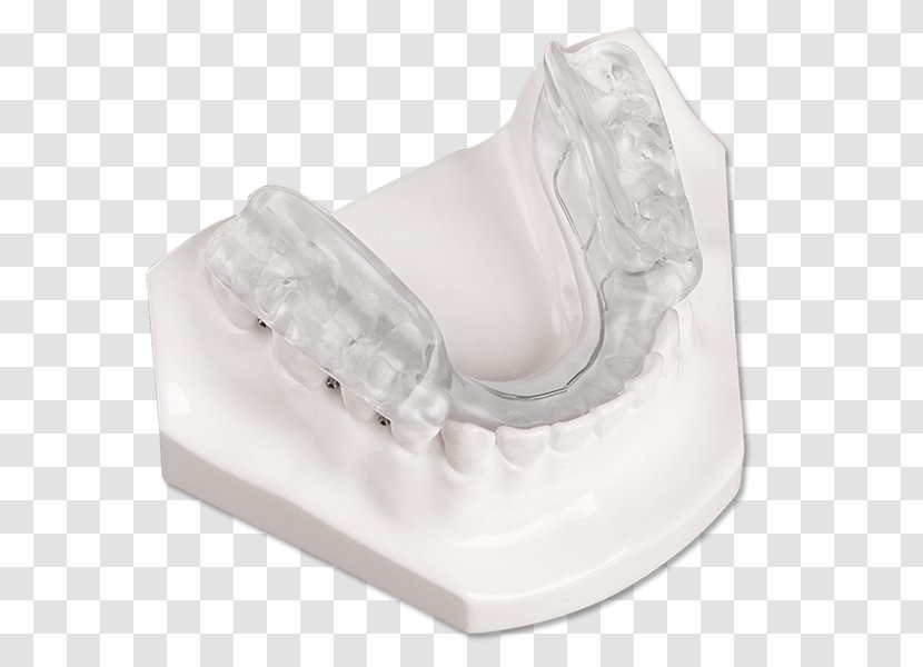 Splint Temporomandibular Joint Dysfunction Jaw Orthotics Twin Block Appliance - Occlusion Transparent PNG