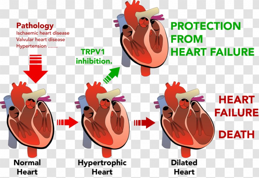 Heart Failure Ventricular Hypertrophy Cardiovascular Disease - Flower Transparent PNG