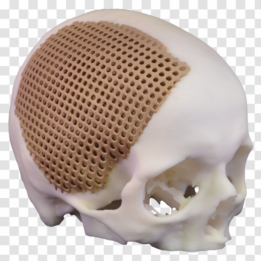 Xilloc Skull Bone Implant Jaw - Head Transparent PNG