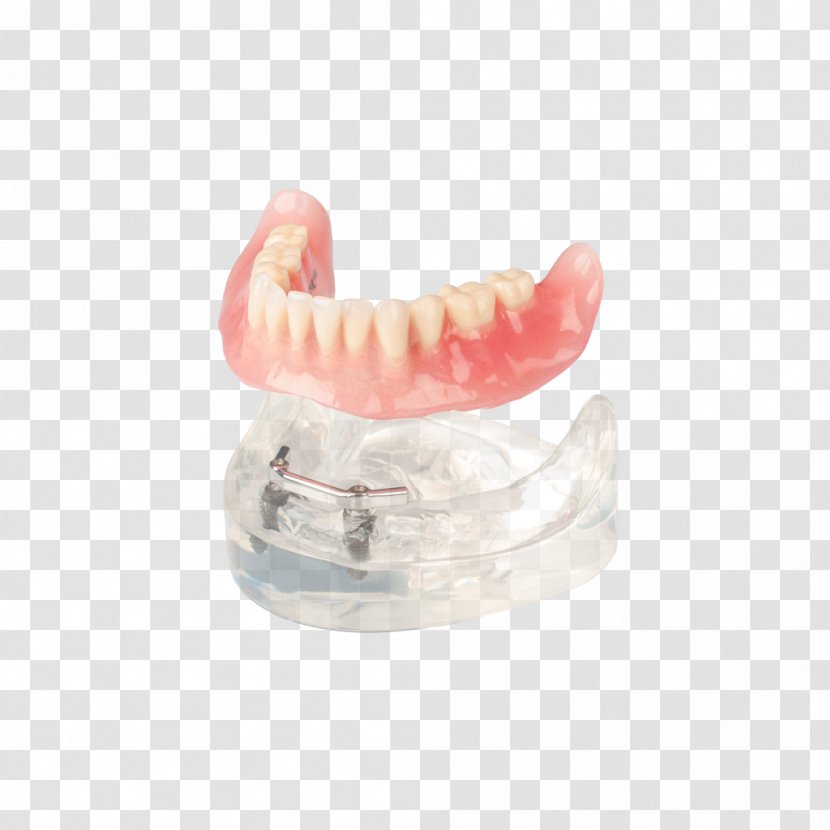 Dentures Tooth Dental Laboratory Implant Dentistry - Traffic Congestion - Various Angles Transparent PNG