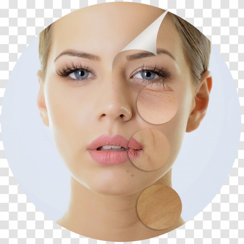 Chemical Peel Skin Wrinkle Facial Exfoliation - Neck - Care Transparent PNG