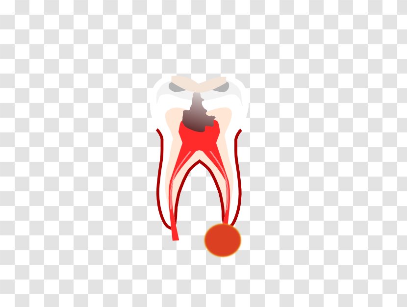 Dentistry Root Canal Crown Tooth Dentures - Silhouette Transparent PNG