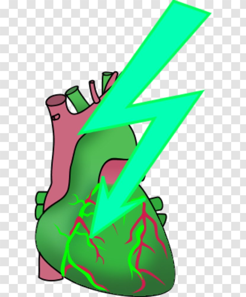 Heart Anatomy Human Body Clip Art - Cartoon - Attack Transparent PNG