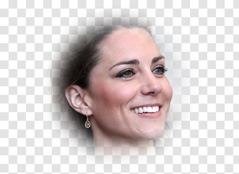 Catherine, Duchess Of Cambridge Wedding Prince William And Catherine Middleton Witton Country Park Rhinoplasty British Royal Family - Forehead Transparent PNG