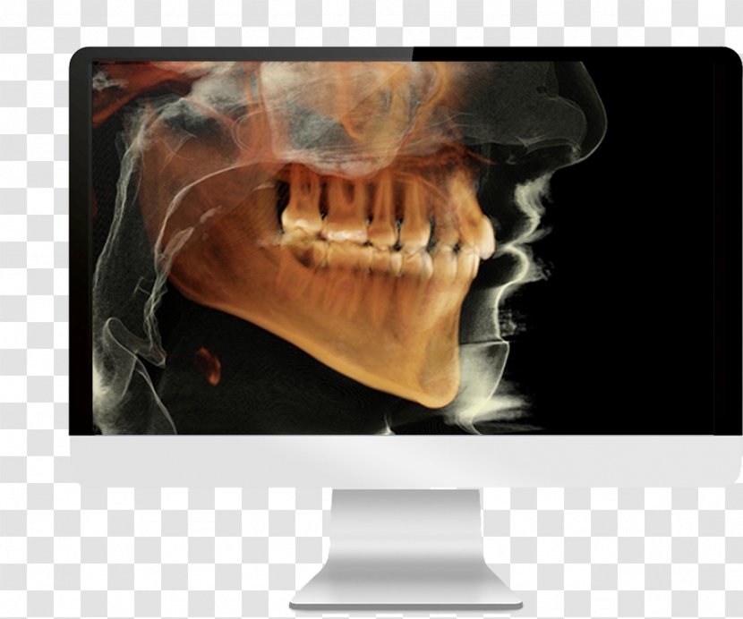 Cone Beam Computed Tomography Dental Radiography Dentistry Transparent PNG