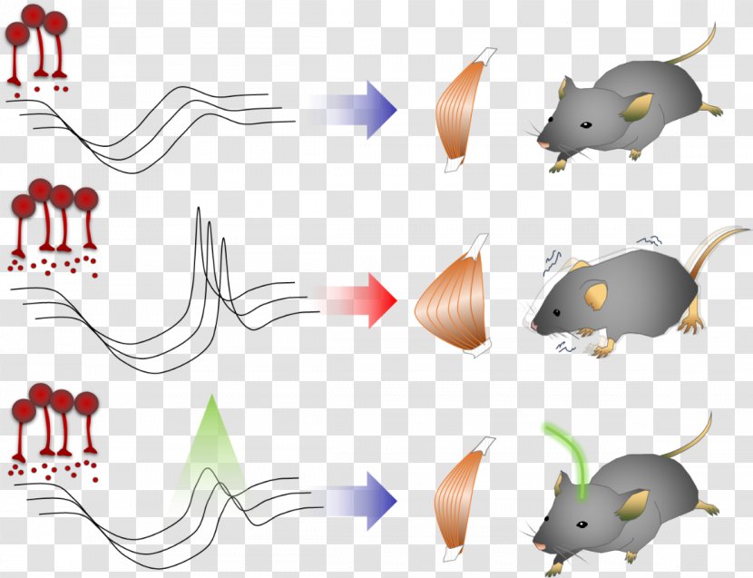 Parkinson's Disease Basal Ganglia KAIST Dystonia - Research Transparent PNG