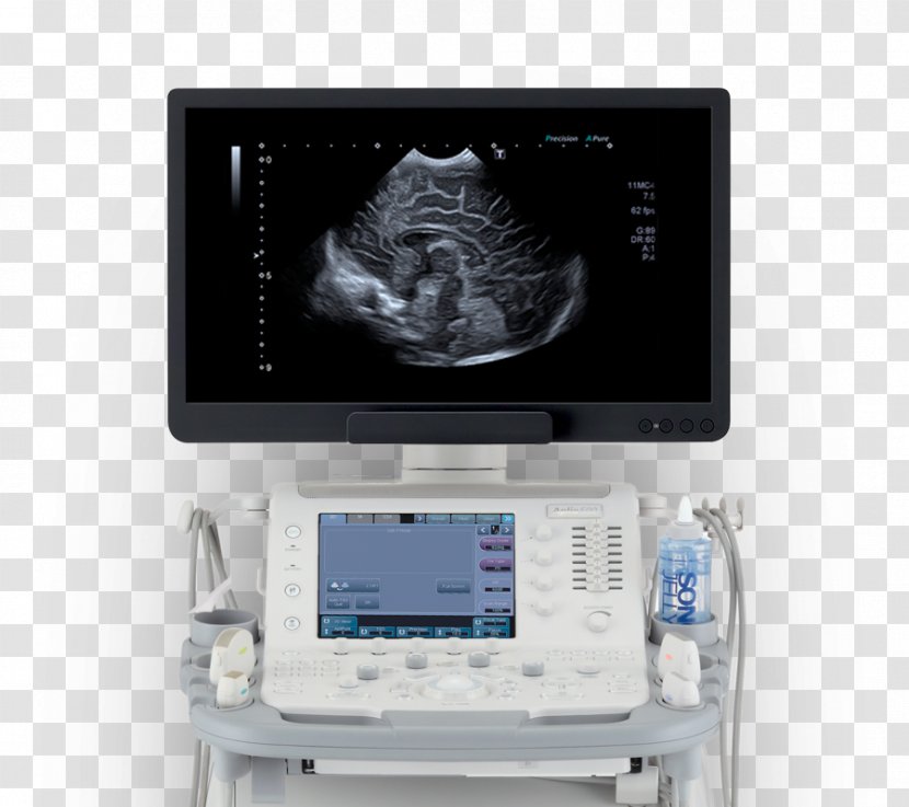 Medical Equipment Ultrasonography Medicine Imaging Diagnosis - Patient - Technology Products Transparent PNG