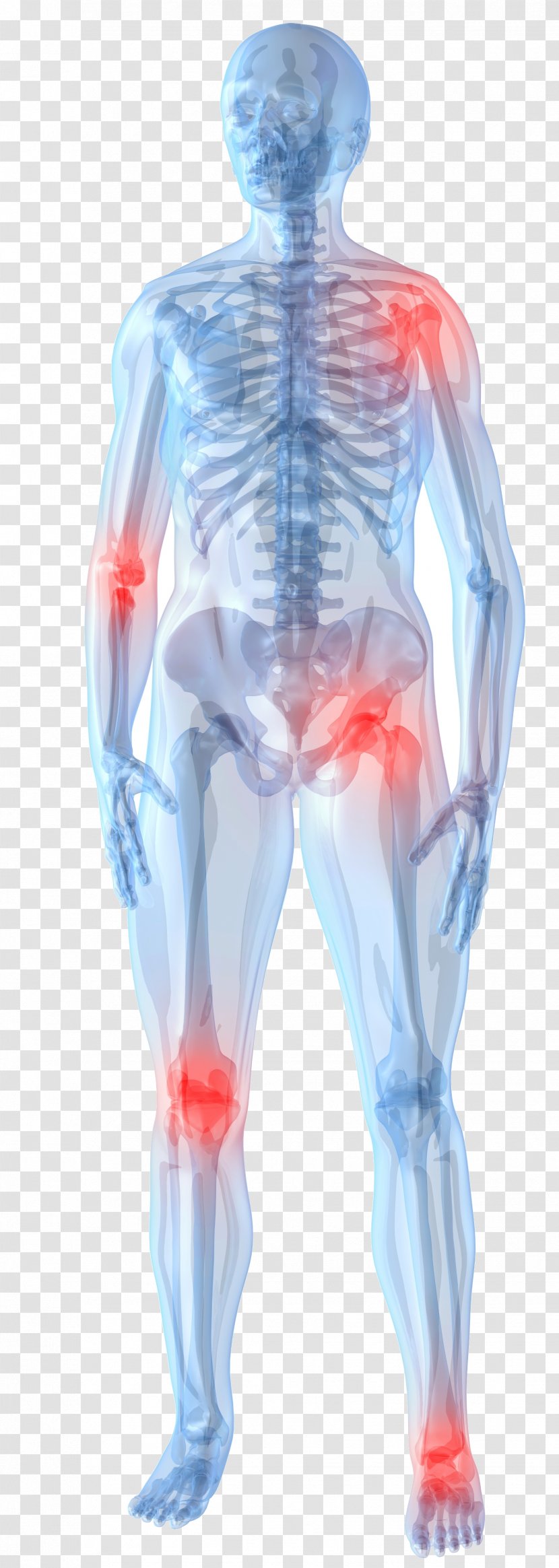 Knee Pain Management Arthritis Joint Therapy - Silhouette Transparent PNG
