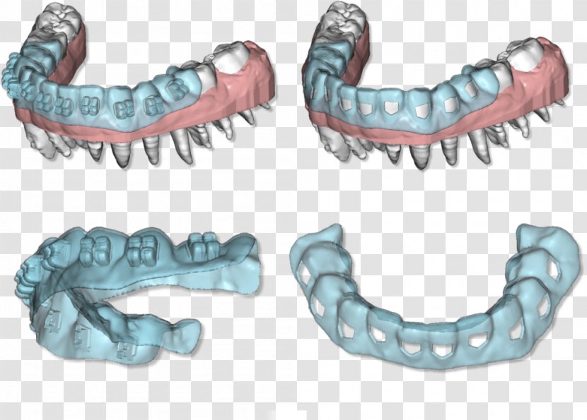Clear Aligners Tooth Orthodontics Dentistry 3D Scanner - 3d Computer Graphics - Dental Template Transparent PNG