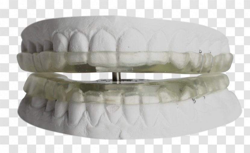 Temporomandibular Joint Dysfunction Orthodontics Dentistry Mouthguard - Sleep And Breathing - Dental Braces Transparent PNG