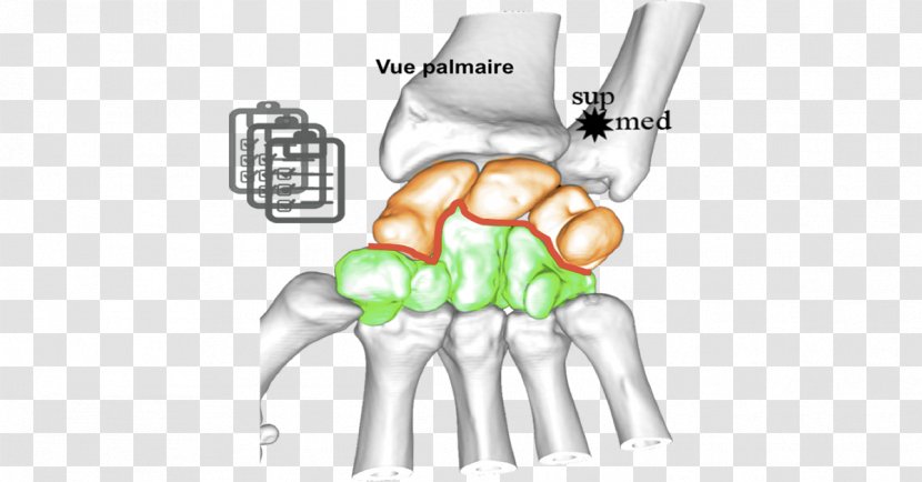 Thumb Carpal Bones Arthrology Wrist - Tree - Watercolor Transparent PNG