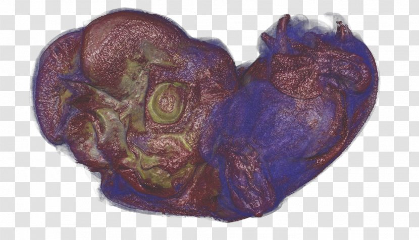 Purple Organism Heart - Cartoon - Biomedicine Transparent PNG