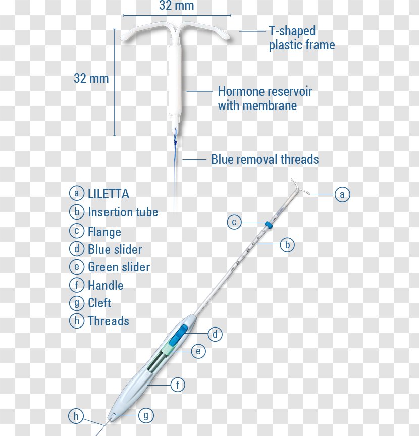 Progestin IUD Intrauterine Device Levonorgestrel Birth Control Liletta - Spermicide Transparent PNG