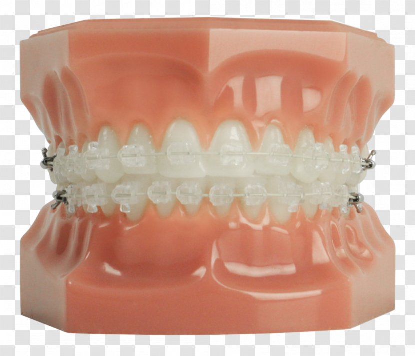 Tooth Dentistry Dental Braces Clear Aligners - Smile Transparent PNG