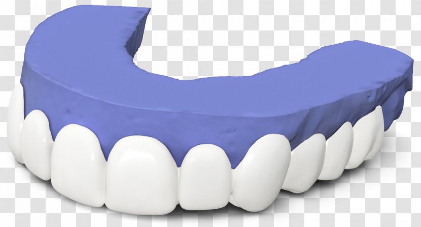 Tooth Veneer Dentistry Dental Laboratory - Brighter Image Transparent PNG