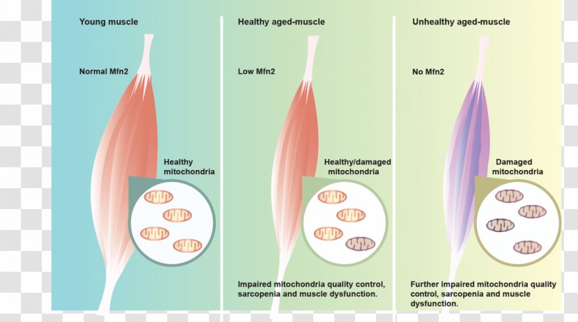 Sarcopenia Muscle Atrophy Ageing Old Age - Symptom - Longevity Transparent PNG