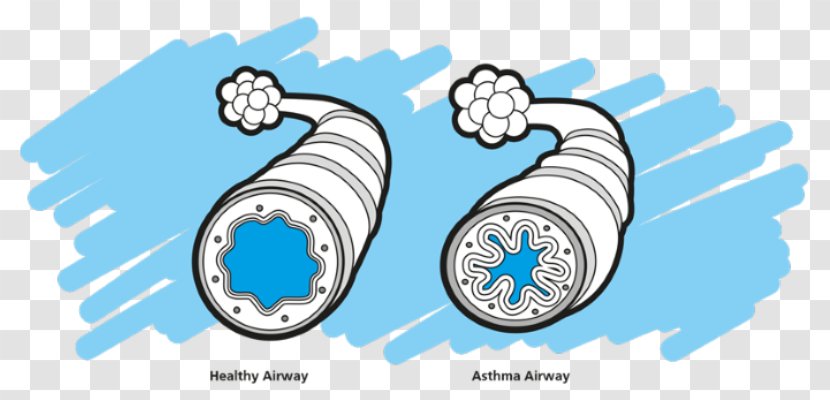 Asthma Spacer Montelukast Nursing Care Clip Art - Organism Transparent PNG