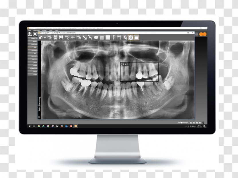 Computer Monitors Medical Imaging Multimedia Product Design - Service - Orange Dentist Transparent PNG