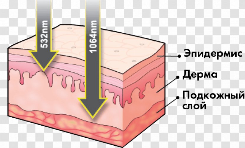 Light Skin Technology Laser Melanin Transparent PNG