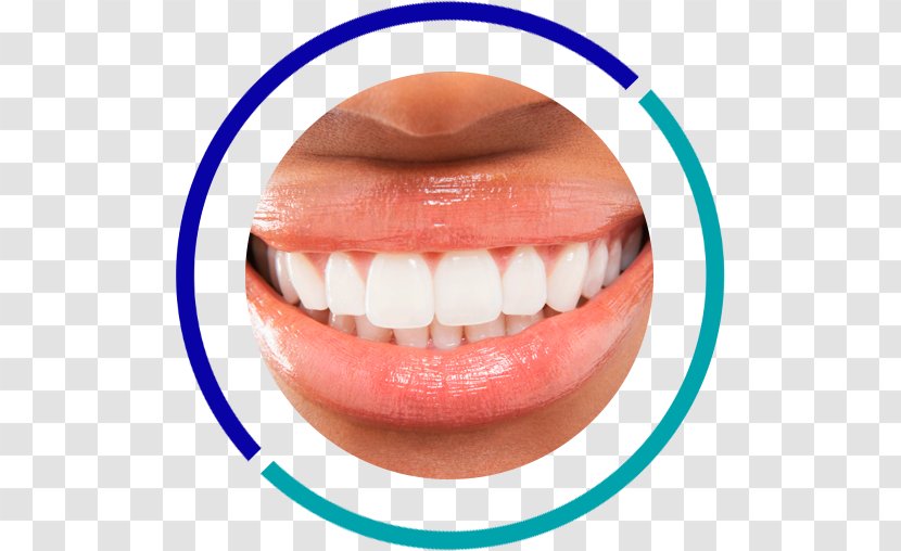 Tooth Whitening Dentistry Human - Mouth - Cosmetic Transparent PNG