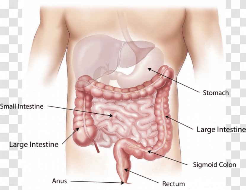 Colorectal Cancer Large Intestine Surgery Rectum - Cartoon - Health Transparent PNG
