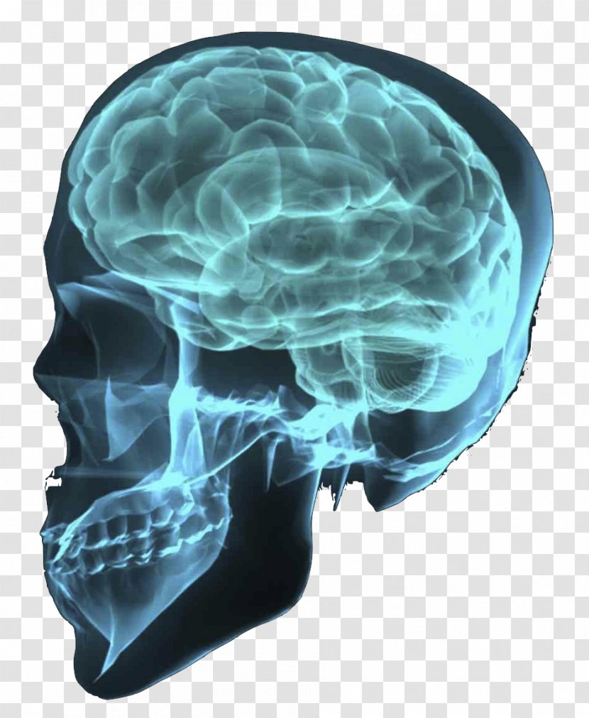 Traumatic Brain Injury Human Tumor - Neuron Transparent PNG