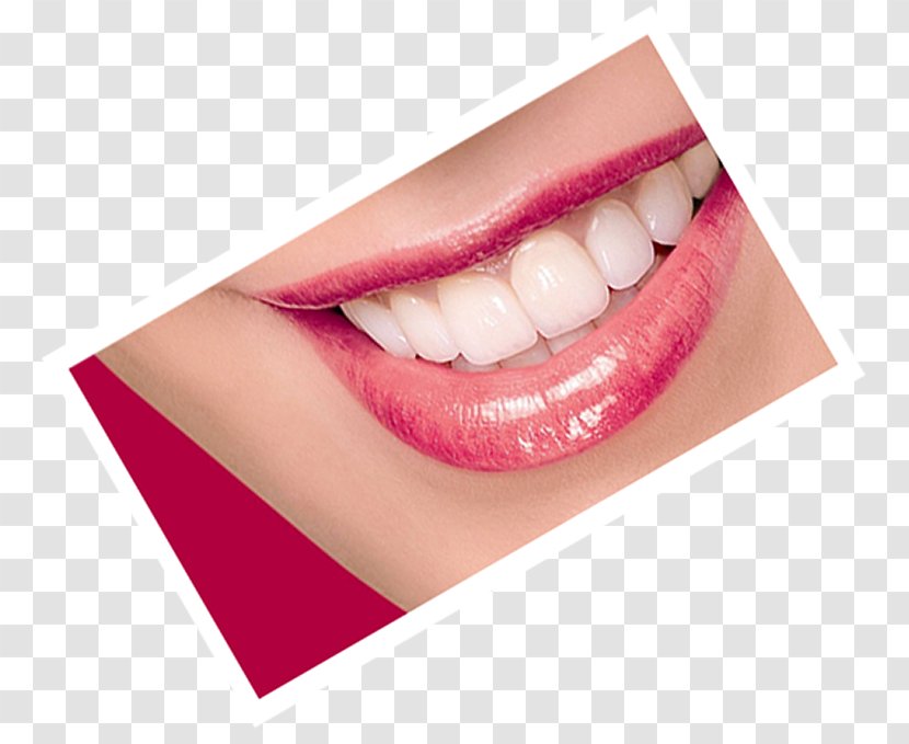 Tooth Dentistry Dental Prosthesis American Association - Artistry - Laboratory Transparent PNG