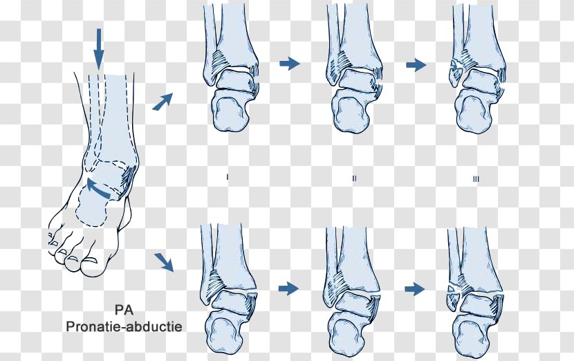 Finger Ankle Boston Celtics Shoe Foot - Watercolor - Fracture Transparent PNG