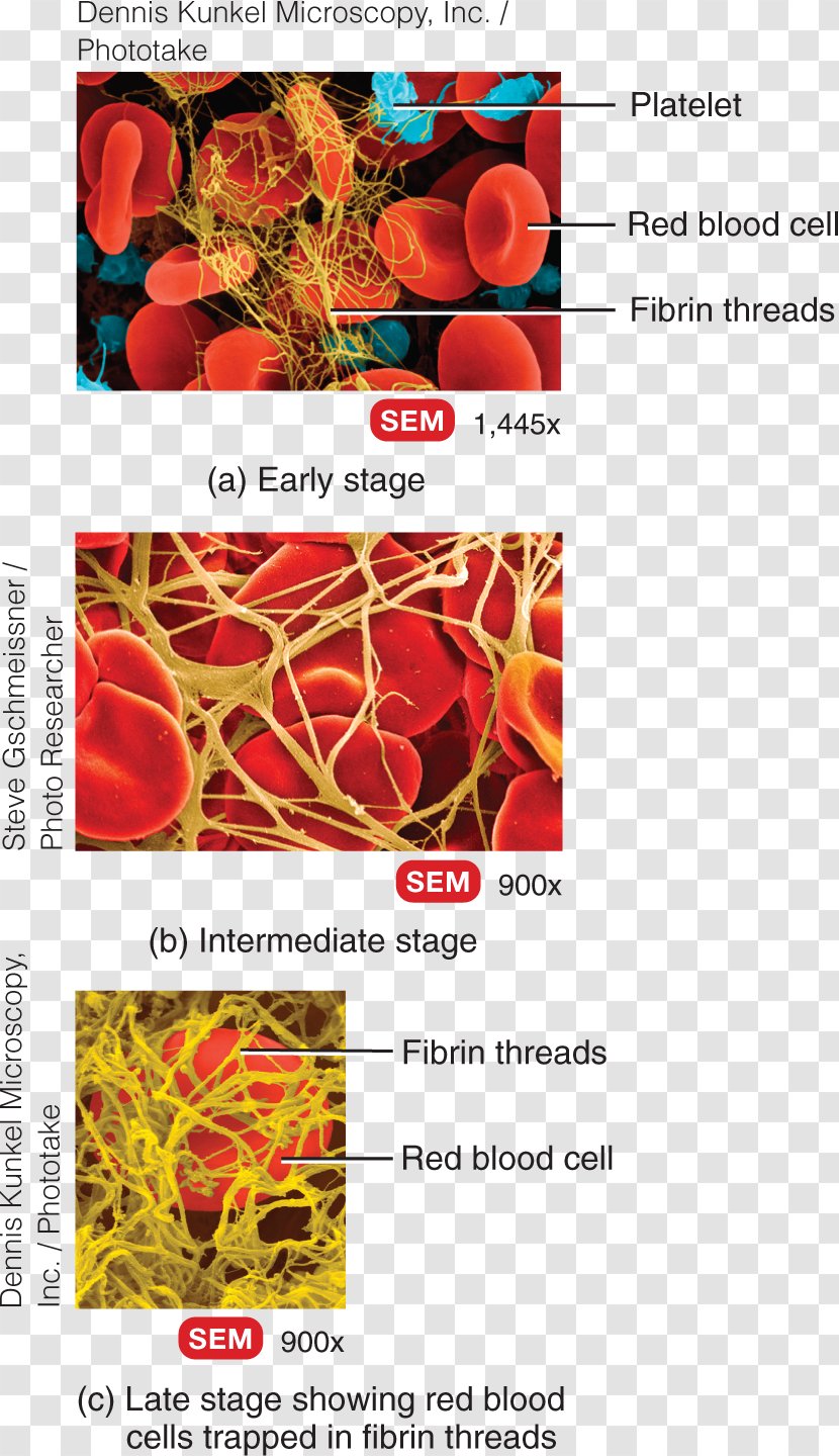 Principles Of Anatomy And Physiology Fibrin Coagulation Blood Thrombus - Disease Transparent PNG