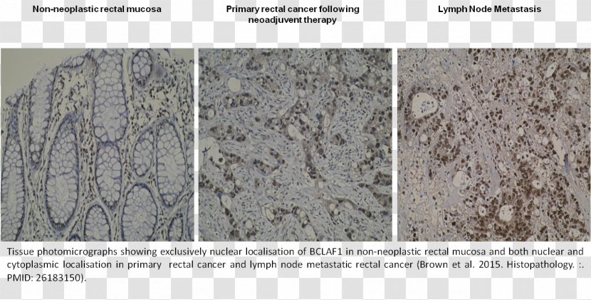 Granite Material - Programmed Cell Death Protein 1 Transparent PNG