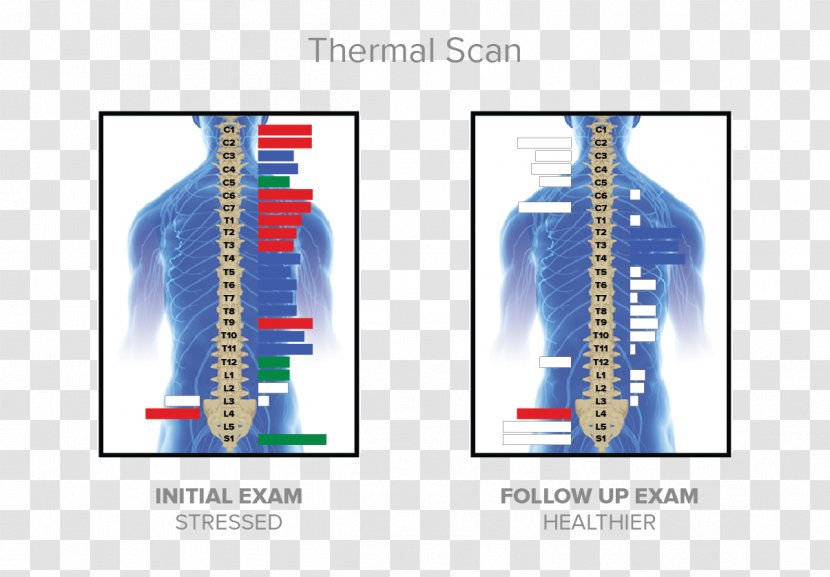 McKillican Chiropractic Chiropractor Nervous System Technology - Brand - Thermal Transparent PNG