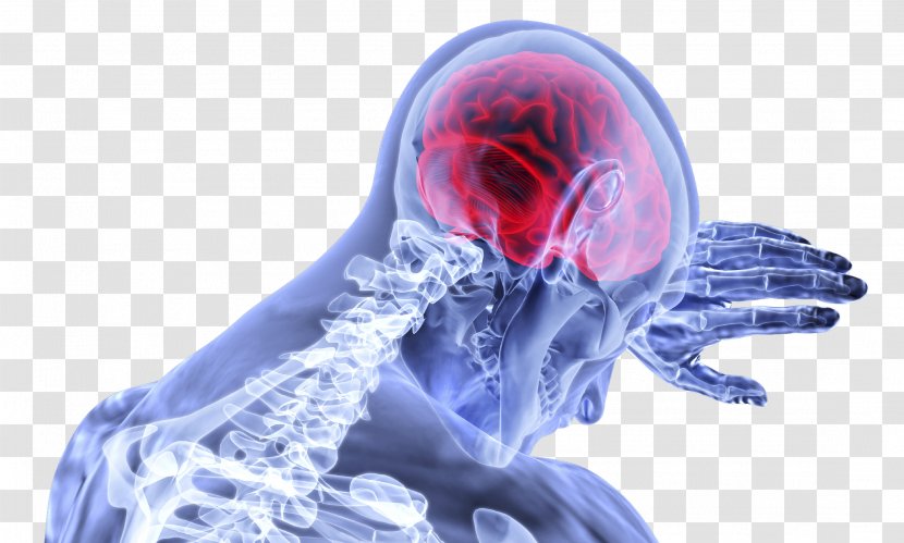 Traumatic Brain Injury Concussion - Frame Transparent PNG