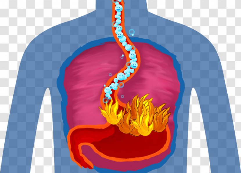 Kidney Stone Health Gout Food Uric Acid - Cartoon Transparent PNG