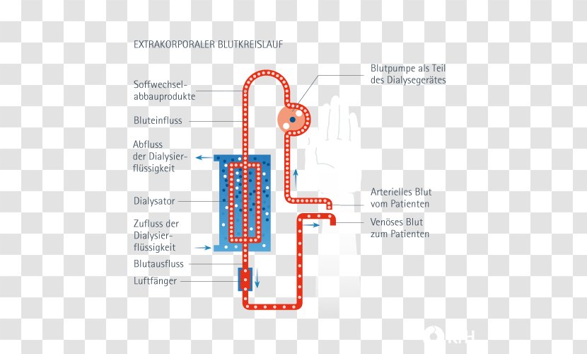 Dialysis Dialysator Blood Medicine Reverse Osmosis - Diagram - Organization Transparent PNG