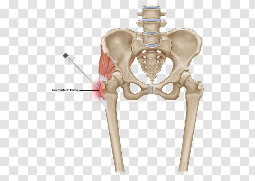 Greater Trochanteric Pain Syndrome Low Back Vertebral Column Muscle Pelvis - Tree - Heart Transparent PNG