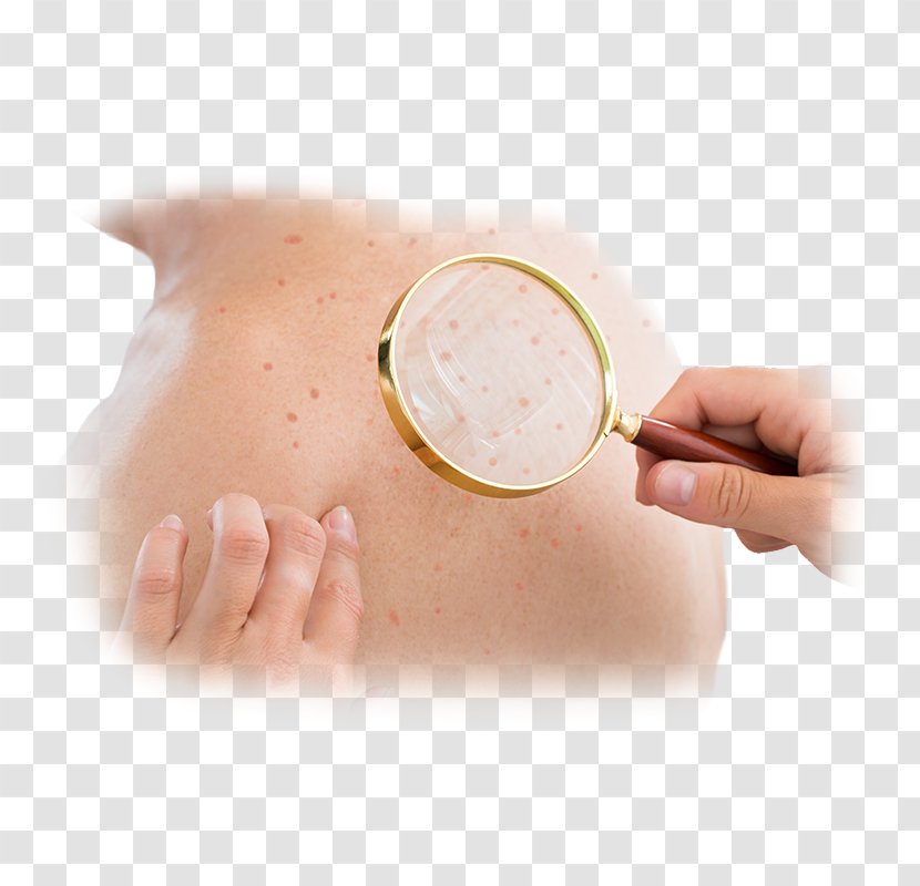 Dermatology Skin Cancer Medicine Disease - Pharmaceutical Drug - Problems Transparent PNG