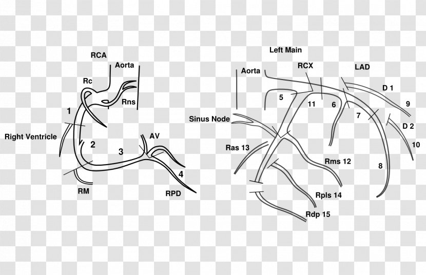 Coronary Arteries Left Artery Anatomy Circulation - Tree - Heart Transparent PNG