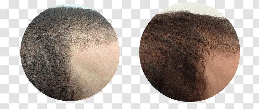Chin Brown Hair Brush Forehead - Ear Transparent PNG
