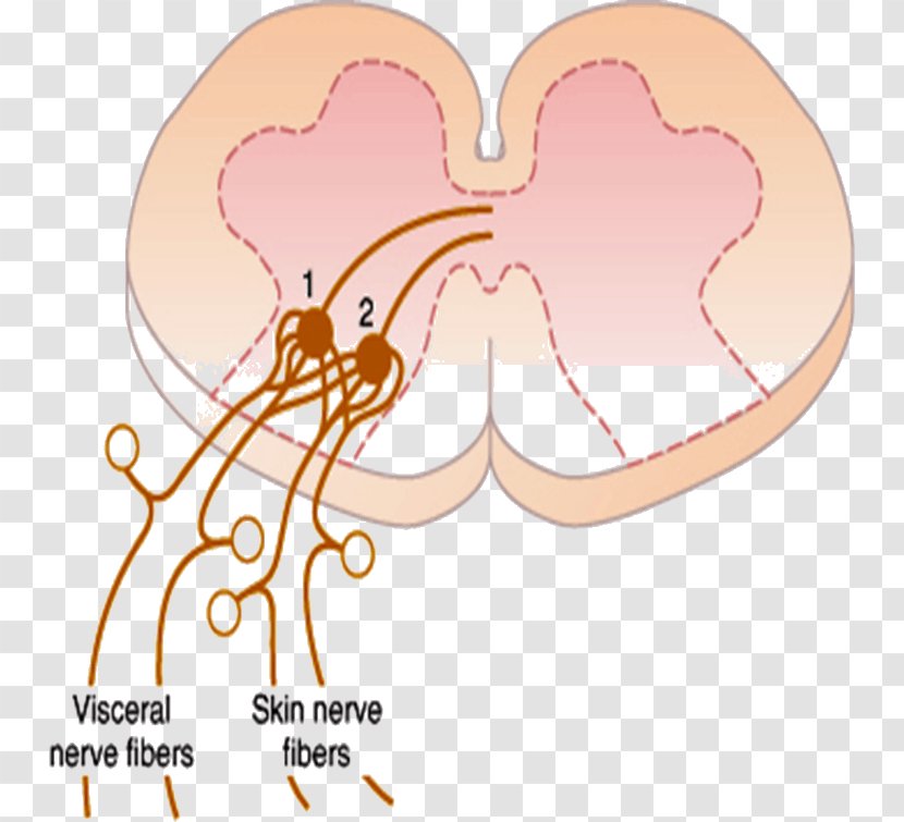 Referred Pain Periaqueductal Gray Ache Stimulus Midbrain - Cartoon - Threshold Of Transparent PNG