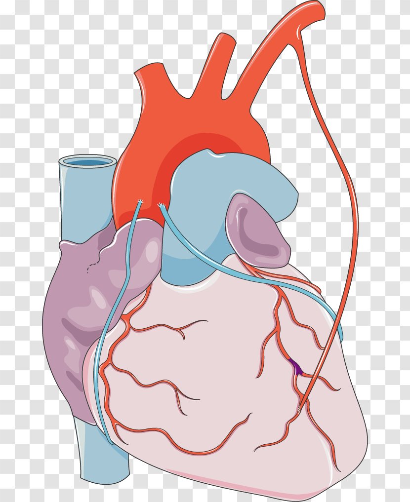 Myocardial Infarction Heart Monocyte Coronary Artery Disease Medical Clip Art - Flower - Anatomy Transparent PNG