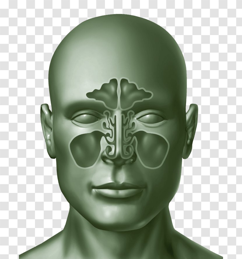 Sinus Infection Allergy Common Cold Nasal Congestion - Functional Endoscopic Surgery Transparent PNG