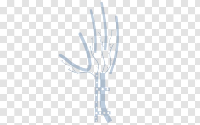 Distal Radius Fracture Wrist Carpal Bones Hand Surgery Bone - Silhouette - Doctor Who Transparent PNG
